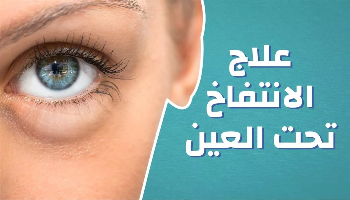الانتفاخ تحت العين